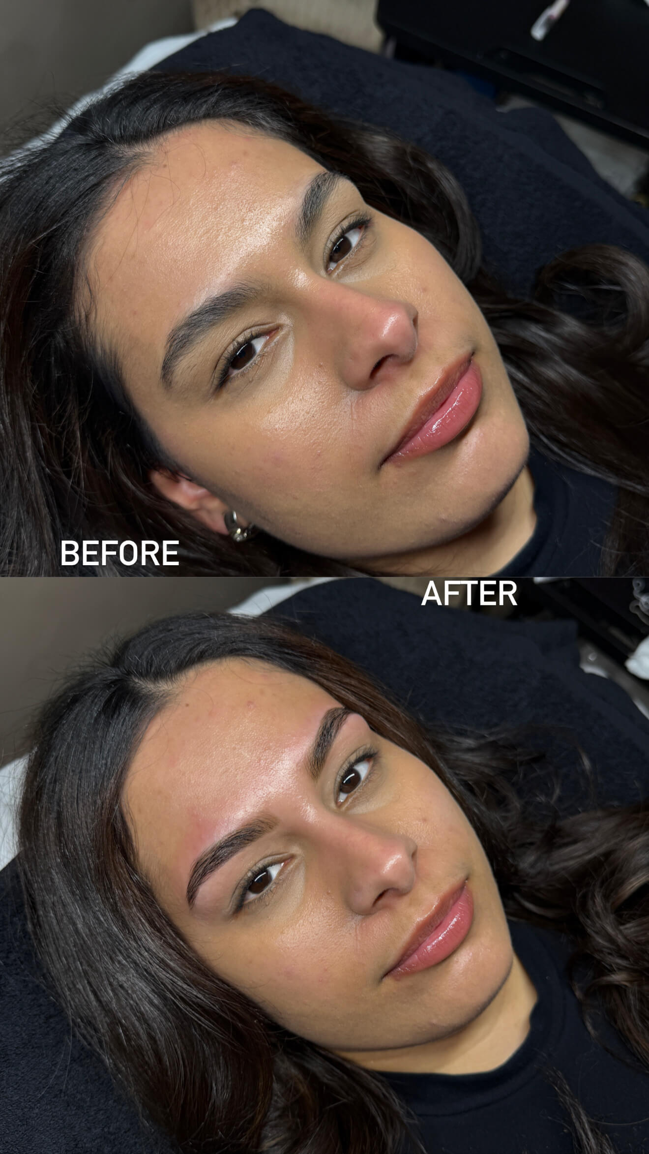 Brow before and after