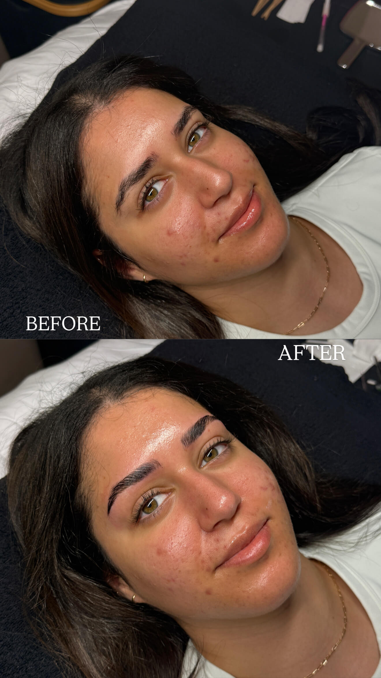 Facial before and after